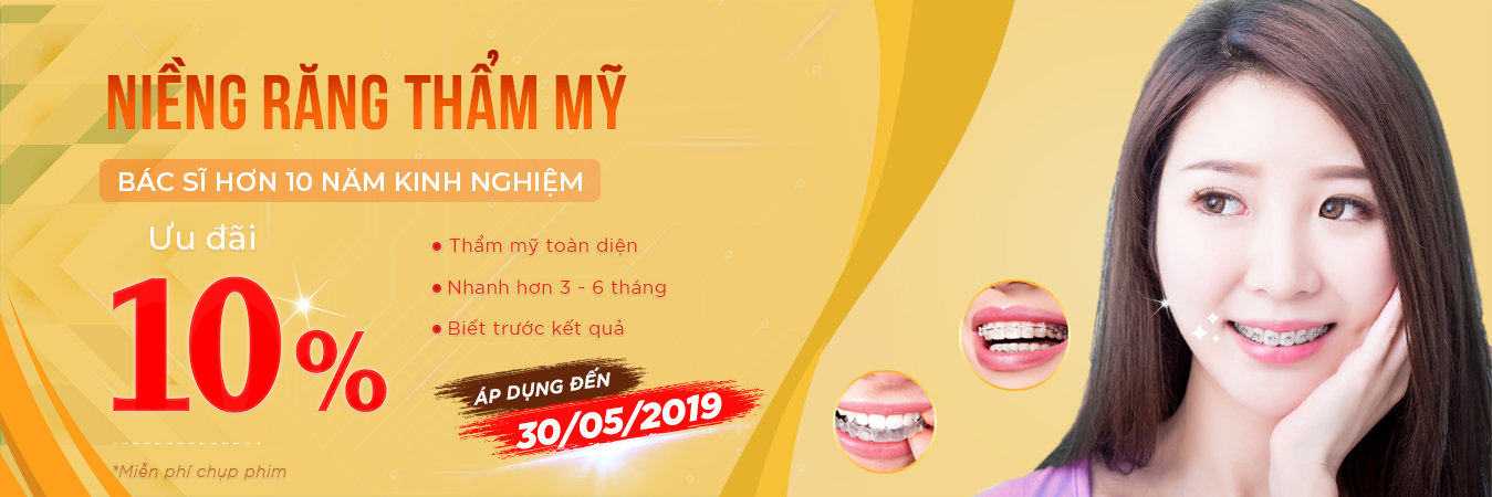 Niềng răng